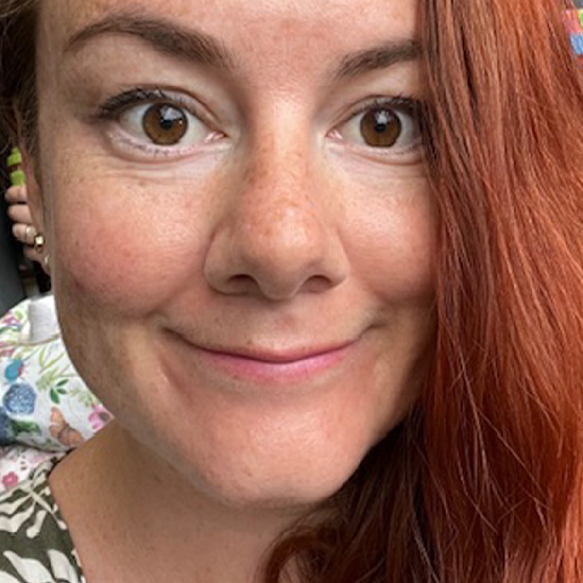 After image of Pigmentation