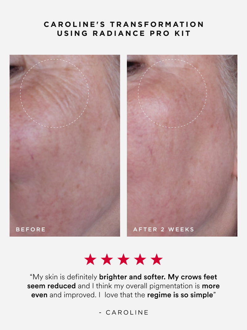 Radiance Pro Kit