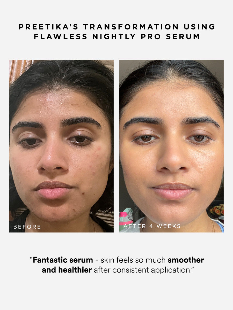 Flawless Nightly Pro 5% Retinoid Serum