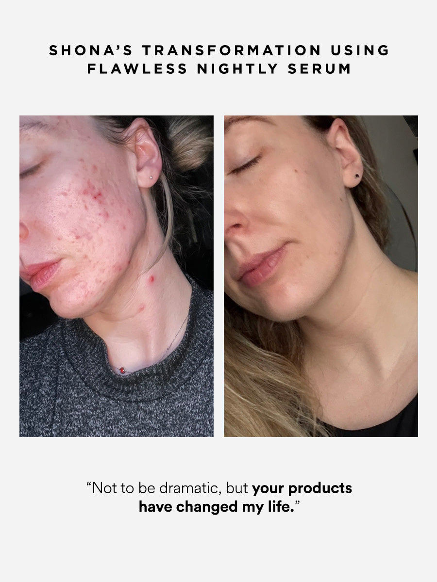 Flawless Nightly Serum | 2% Retinoid Serum | Dr Sam's