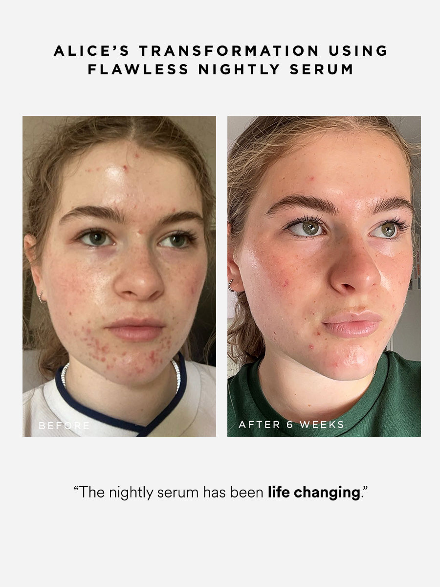 Flawless Nightly Serum | 2% Retinoid Serum | Dr Sam's