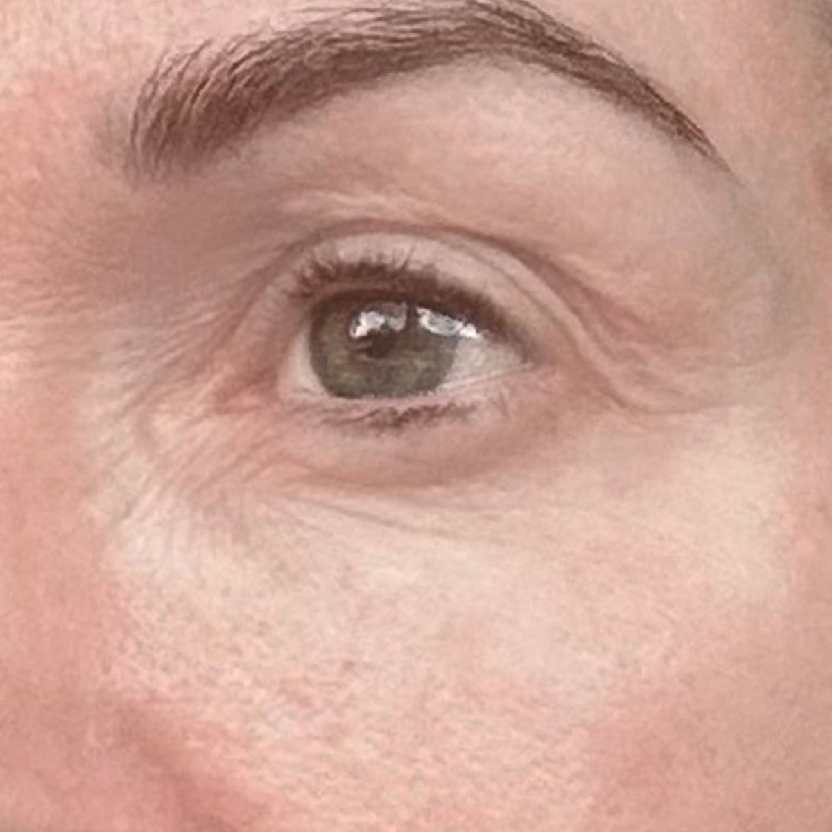 After image of 