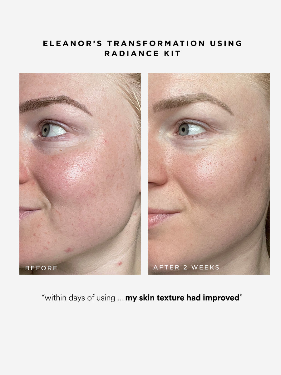 Radiance Kit