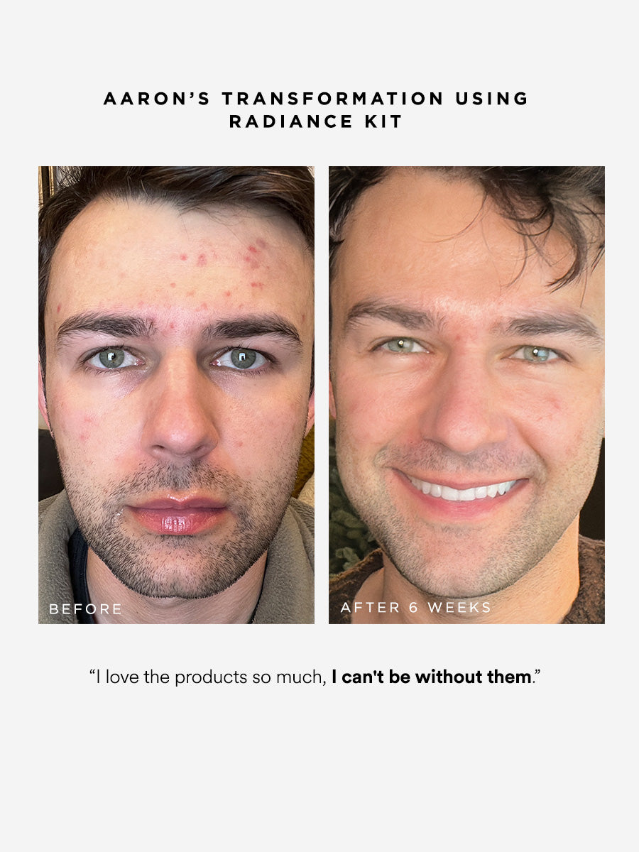 Radiance Kit