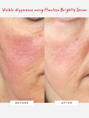 Dr Sam's Flawless Brightly Serum Visible Results In Just 4 Weeks