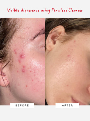 Dr Sam's Visible Results With Flawless Cleanser